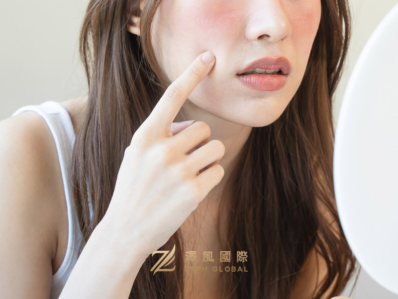 外泌體, 幹細胞, 醫美術後保養, 醫美術後, 韓系保養, 澤風國際